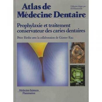 Prophylaxie et traitement conservateur des caries dentaires