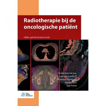 Radiotherapie bij de oncologische patiënt