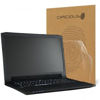 Celicious ToughScreen Anti‑Shatter Film (Clevo N170RF1)