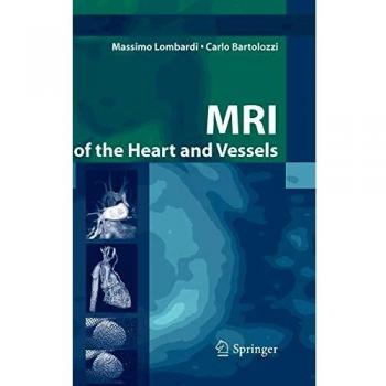 MRI of the heart and vessels
