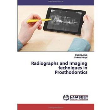 Radiographs and Imaging techniques in Prosthodontics