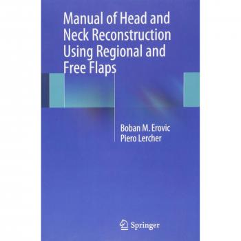 Manual of Head and Neck Reconstruction Using Regional and Free Flaps