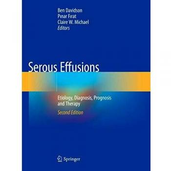 Serous Effusions: Etiology, Diagnosis, Prognosis and Therapy