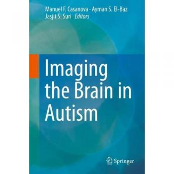Imaging the Brain in Autism