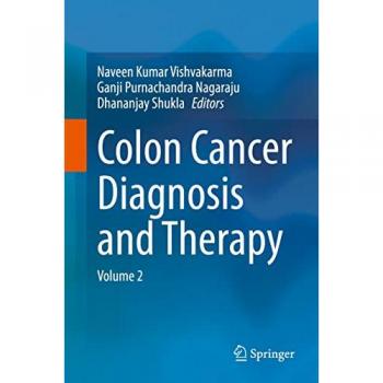 Colon Cancer Diagnosis and Therapy: Volume 2