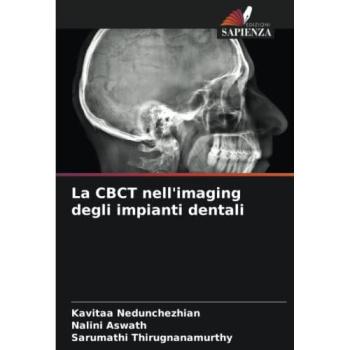 La CBCT nell'imaging degli impianti dentali