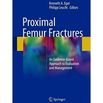 Proximal Femur Fractures