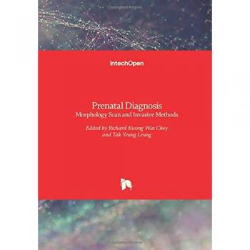 Prenatal Diagnosis