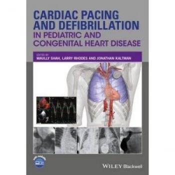 Cardiac Pacing and Defibrillation in Pediatric and Congenital Heart Disease