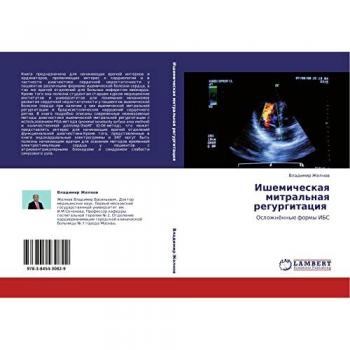 Ишемическая митральная регургитация: Осложнённые формы ИБС: Oslozhnönnye formy IBS