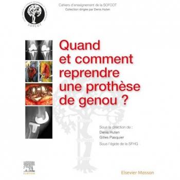 Denis Huten Quand Et Comment Reprendre Une Prothèse De Genou ?