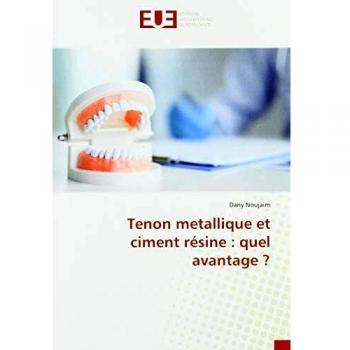 Noujaim Dany Tenon metallique et ciment résine quel avantage ?
