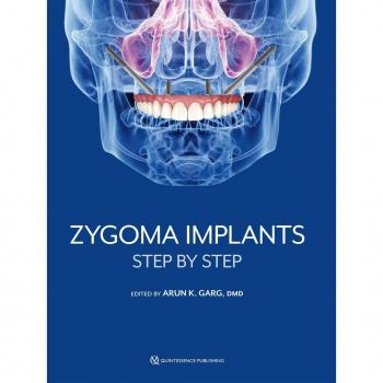 Vitalsource Technologies, Inc. Zygoma Implants: Step by Step