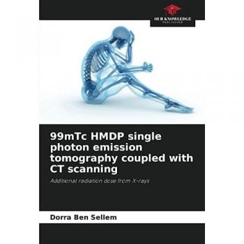 Ben Sellem, Dorra: 99mTc HMDP single photon emission tomography coupled with CT scanning