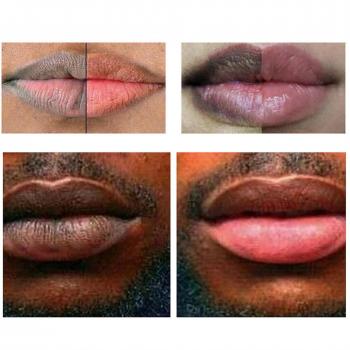 Esencia para Labios Rosa Fresca, Elimina Manchas Oscuras