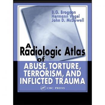 A Radiologic Atlas of Abuse Torture Terrorism and Inflicted Trauma