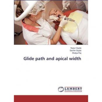 Glide path and apical width