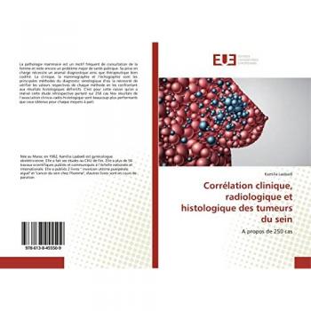Corrélation clinique, radiologique et histologique des tumeurs du sein: A propos de 250 cas