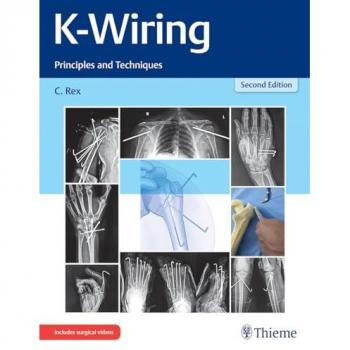 K-Wiring