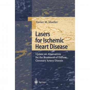 Lasers for Ischemic Heart Disease