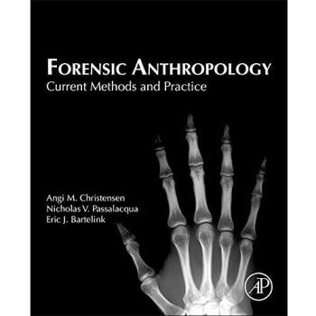 Forensic Anthropology : Current Methods and Practice