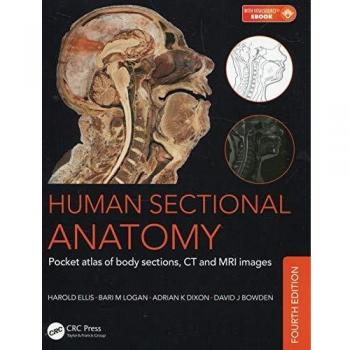 Human Sectional Anatomy: Pocket Atlas of Body Sections, CT and MRI Images