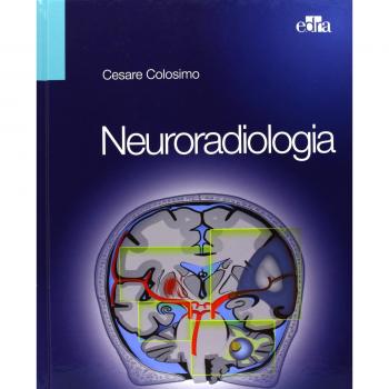 Neuroradiologia
