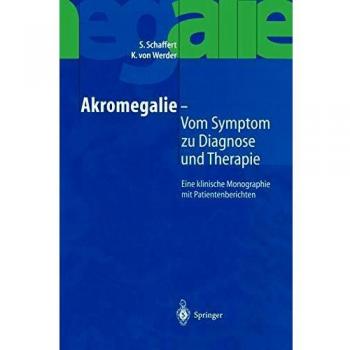 Akromegalie