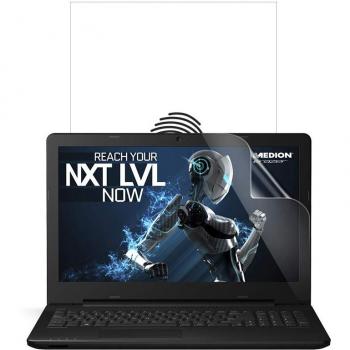 Medion ClearView Vivid + – 2‑Piece Anti‑Glare Shield