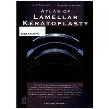 Atlas of lamellar keratoplasty. Con DVD