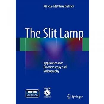 The Slit Lamp