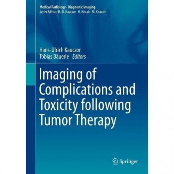 Imaging of Complications and Toxicity following Tumor Therapy