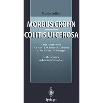 Morbus Crohn