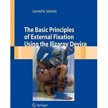 The basic principles of external skeletal fixation using Ilizarov device Leonid Solomin