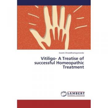 Vitiligo