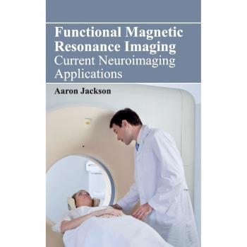 Functional Magnetic Resonance Imaging