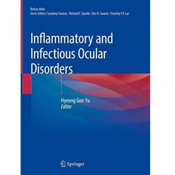 Inflammatory and Infectious Ocular Disorders (Retina Atlas, Band 5)