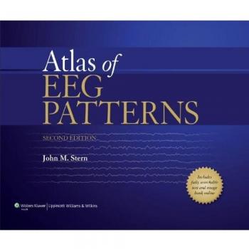 Atlas of EEG Patterns by John M. Stern