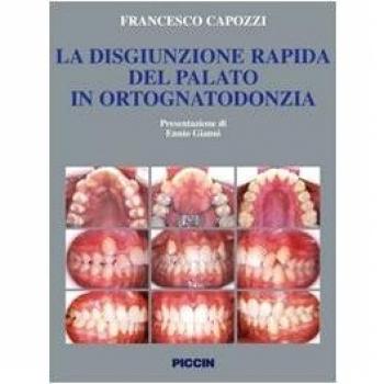 La disgiunzione rapida del palato in ortognatodonzia