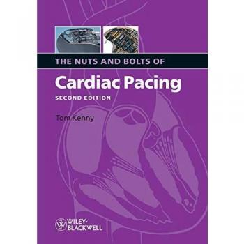 The Nuts and Bolts of Cardiac Pacing