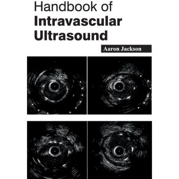 Handbook of Intravascular Ultrasound