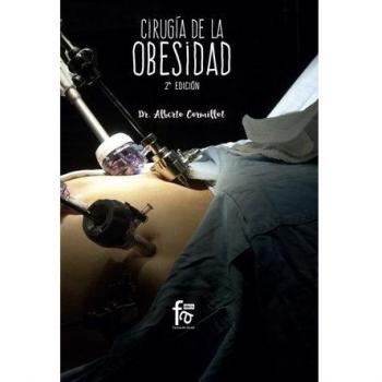 Cirugía de la obesidad