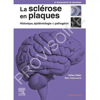 La sclérose en plaques