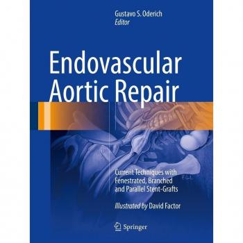 Endovascular Aortic Repair
