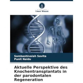 Aktuelle Perspektive des Knochentransplantats in der parodontalen Regeneration