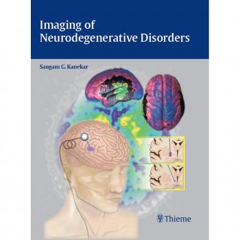 Imaging of Neurodegenerative Disorders