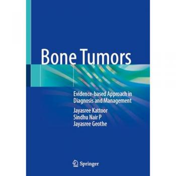 Bone Tumors