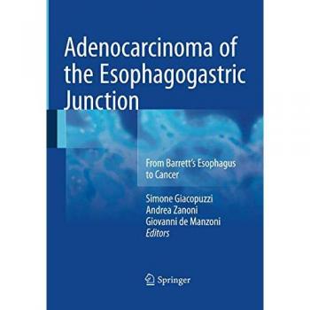 Adenocarcinoma of the Esophagogastric Junction