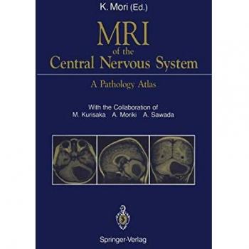 MRI of the Central Nervous System