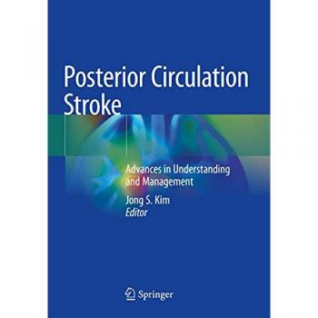 Posterior Circulation Stroke